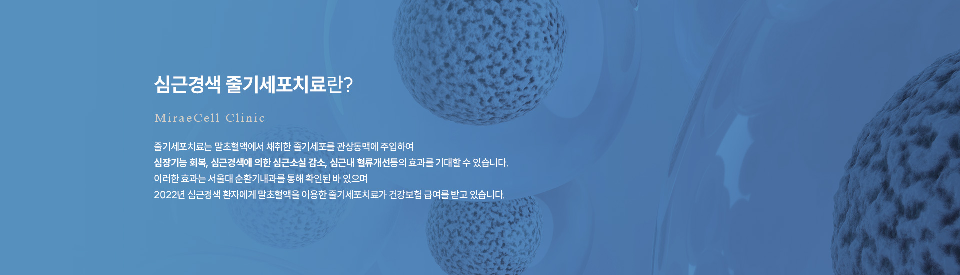 심근경색 줄기세포치료