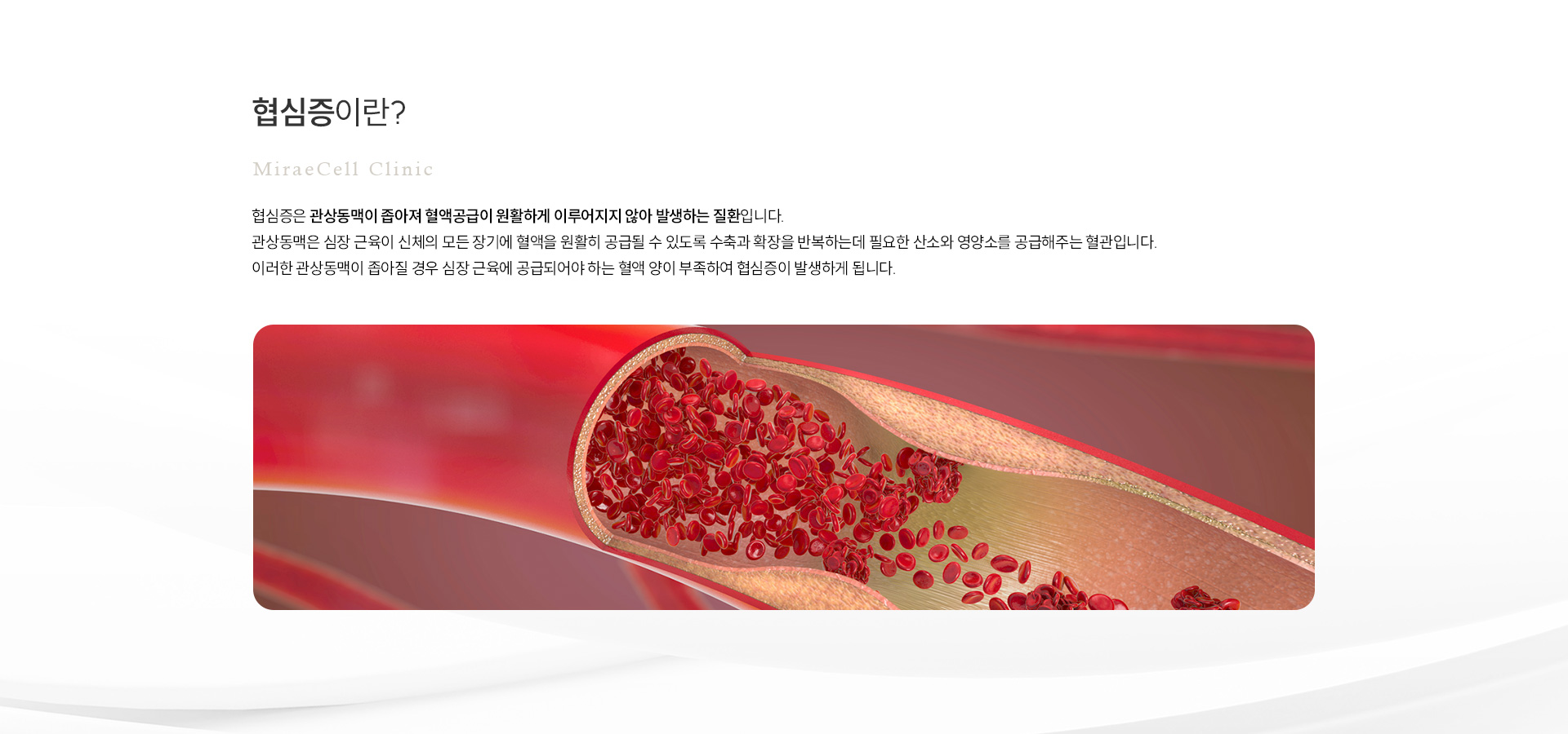 협심증 정의