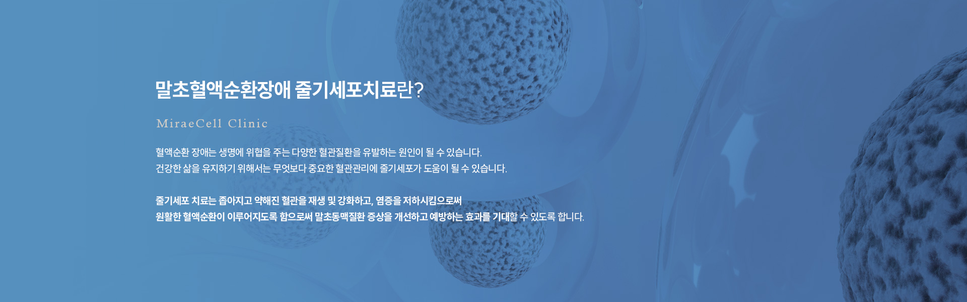 말초혈액순환장애 줄기세포