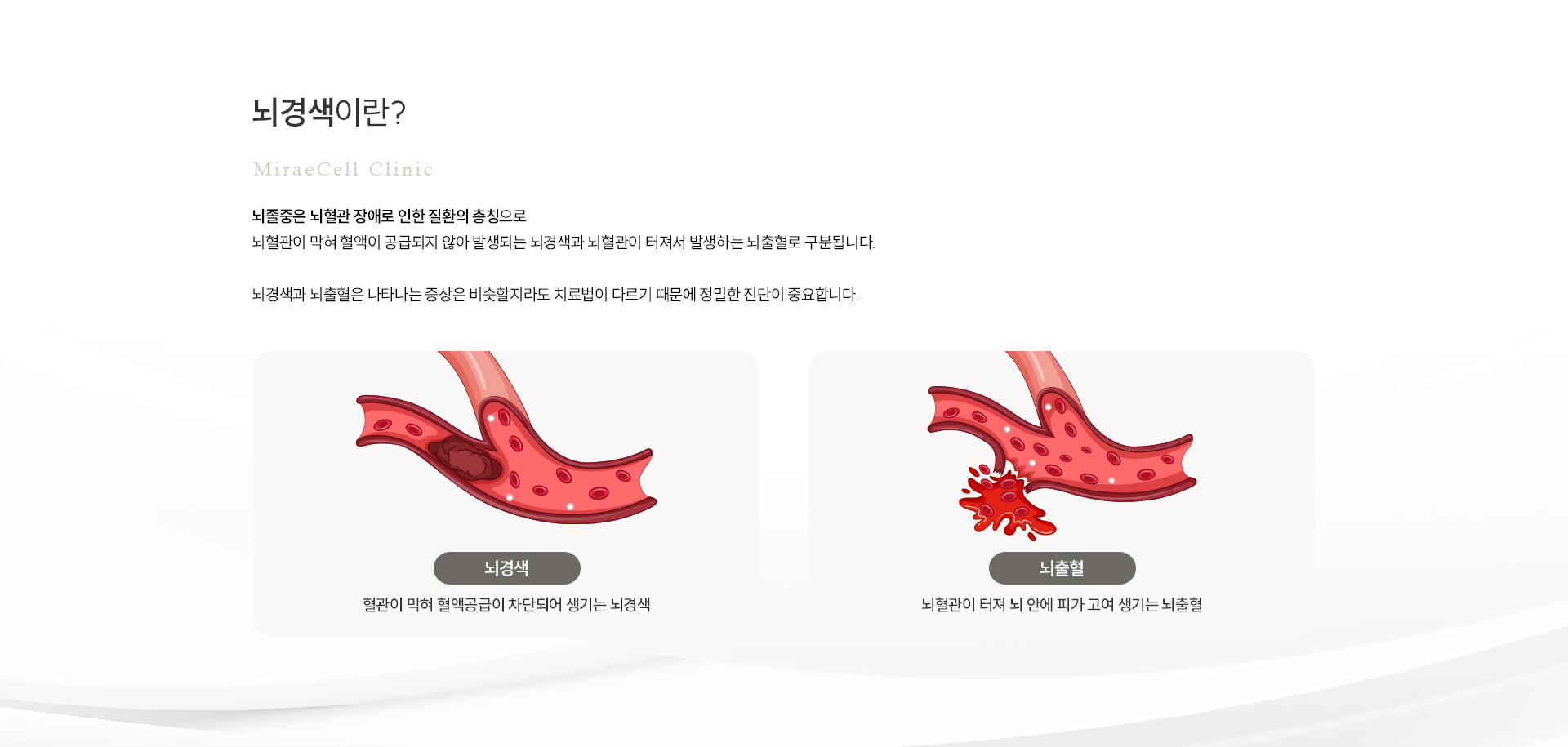 뇌졸중 정의
