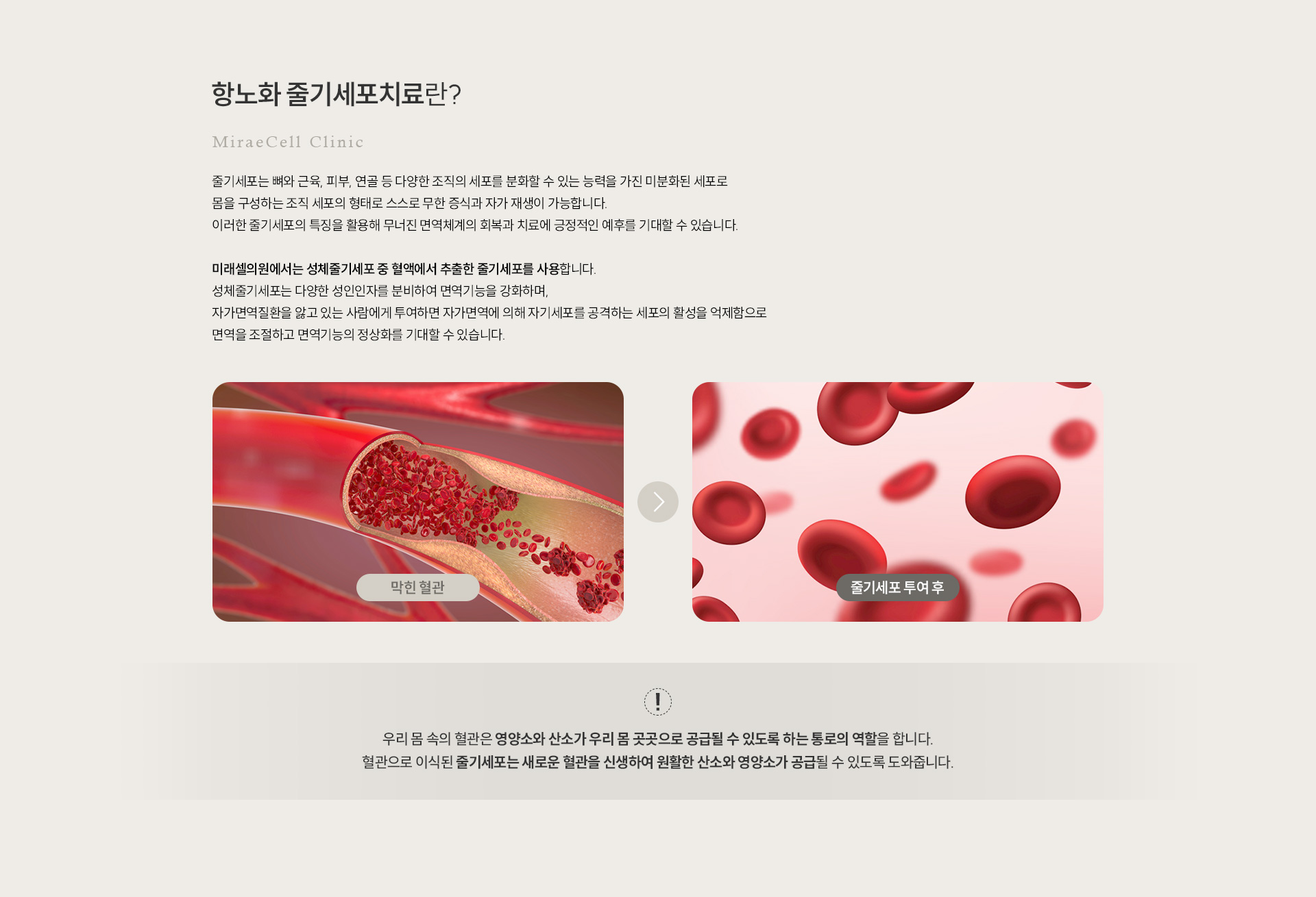노화 줄기세포치료