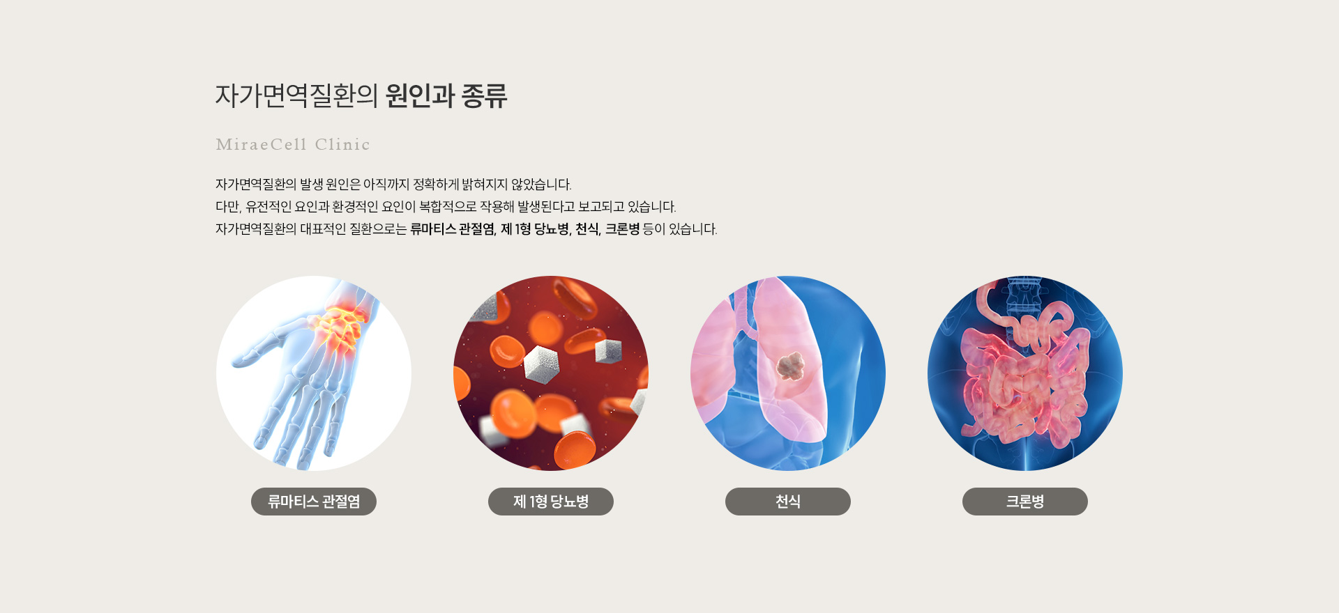 자가면역질환 원인과종류