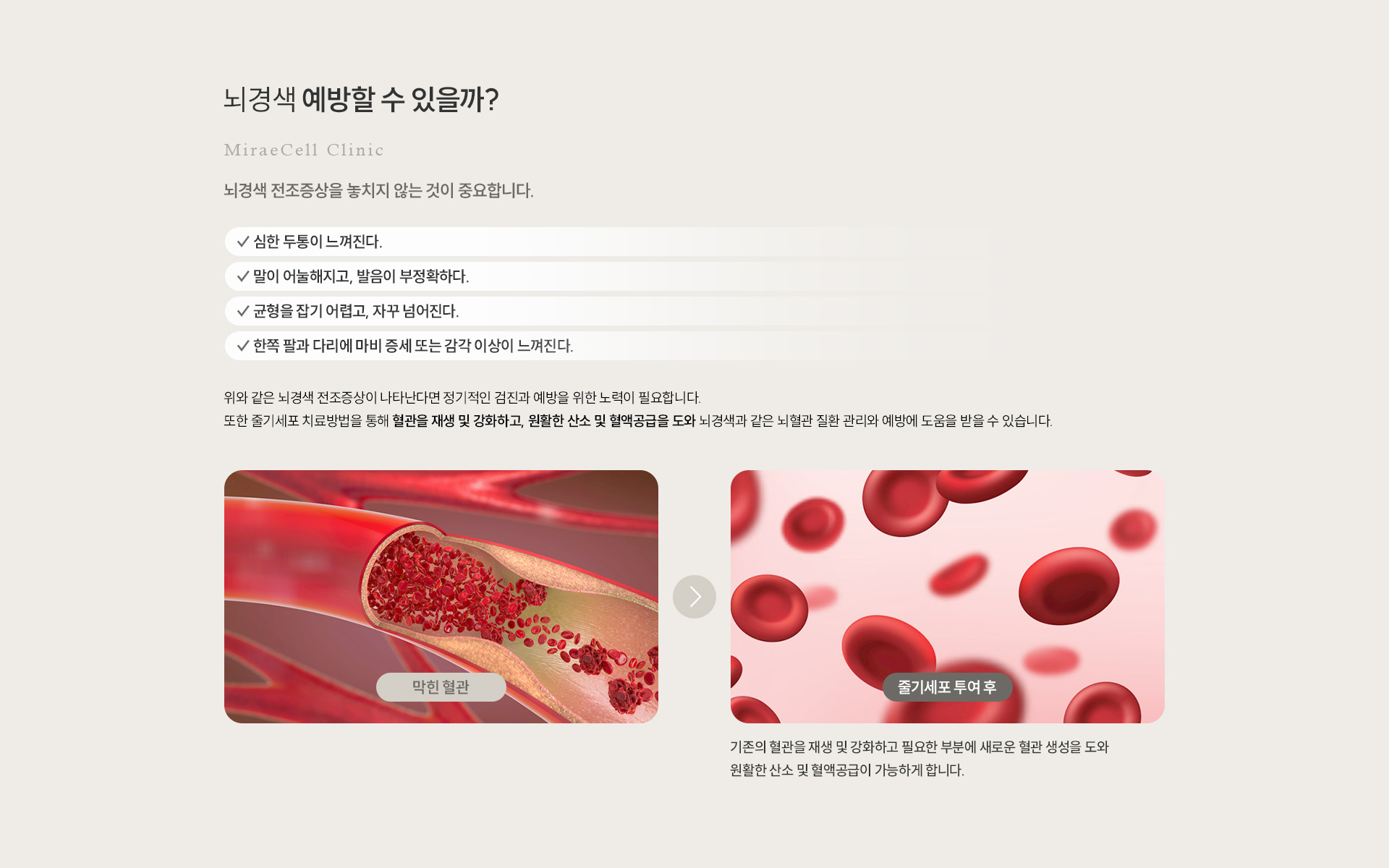뇌경색 예방 및 후유증 감소 예방