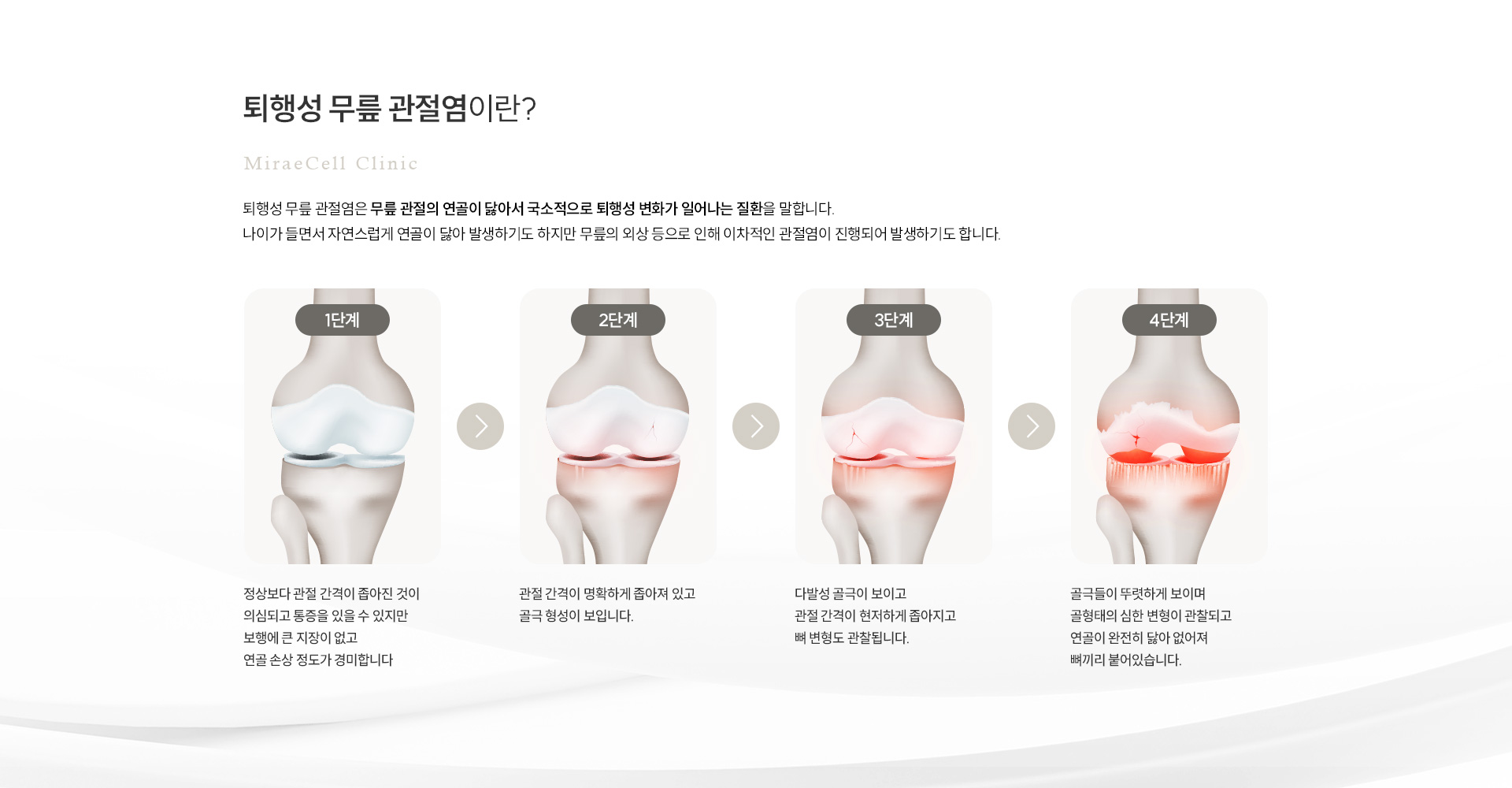 퇴행성 무릎 관절염 정의
